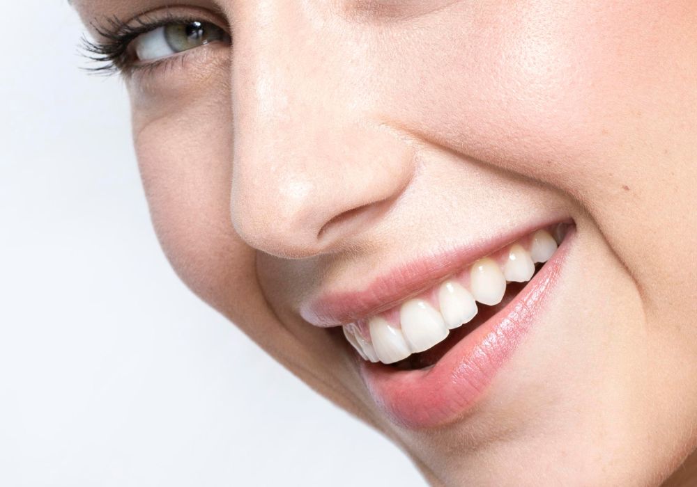 blanqueamiento dental